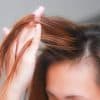 علاجات طبيعية يمكن أن تمنع تساقط الشعر