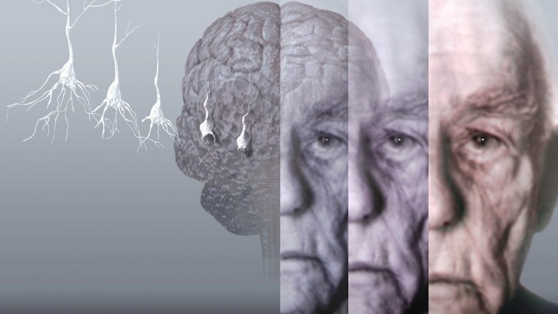 العلاقة بين تلوث الهواء والزهايمر
