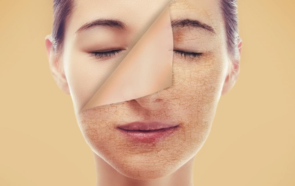 طرق فعالة لمواجهة شحوب الوجه
