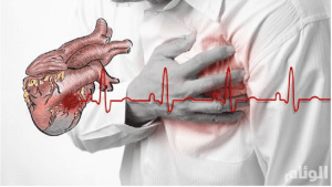 HLH  مرض يصيب الجهاز  المناعي .. وتحذيرات من انتشاره