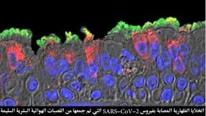 خارطة جديدة لعدوى كورونا في تجويف الأنف تدعم فعالية ارتداء الأقنعة