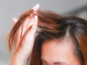علاجات طبيعية يمكن أن تمنع تساقط الشعر