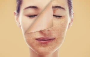 طرق فعالة لمواجهة شحوب الوجه