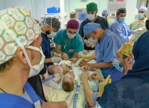 بدء عملية فصل التوأم السيامي اليمني “مودة ورحمة”