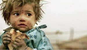 الأمم المتحدة: 882 مليون شخص يعانون من الجوع حول العالم