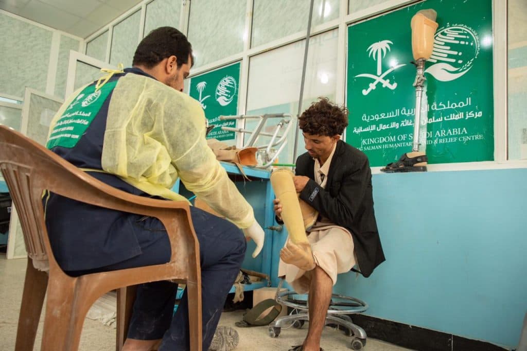 استفادة 1697 مريضًا من مركز الأطراف الصناعية بمستشفى مأرب خلال 6 أشهر