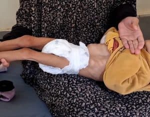 وفاة طفلة فلسطينية جوعًا.. و”الأونروا”: الاحتلال الإسرائيلي يتعمد تجويع سكان قطاع غزة
