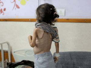 “يونيسيف”: الحروب والصراعات أدخلت ملايين الأطفال في مجاعات غير مسبوقة خلال عام 2025