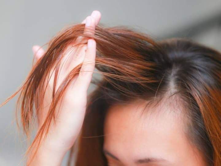 علاجات طبيعية يمكن أن تمنع تساقط الشعر