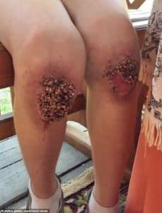 عنف منزلي مبتكر ومروع من أم وزوجها في حق طفل عمره 8 سنوات