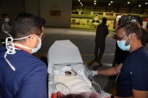 إجراء عملية فصل التوأم الطفيلي اليمني عائشة غدًا