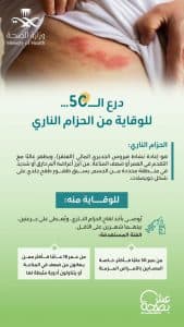 وزارة الصحة تُواصل فعاليات التوعية ضد مرض الحزام الناري تزامنًا مع الأسبوع العالمي للتحصينات